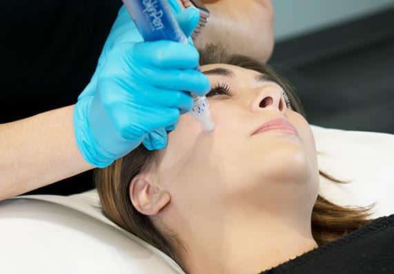 1746555573 image1 1 Is Microneedling Right for You?
