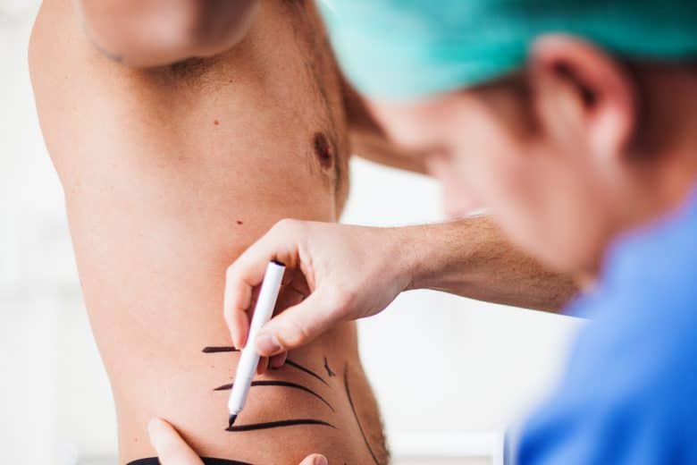 1746555675 iStock 187044397 780x520 1 ‘Gym Selfies’ Driving Surge In Male Implants