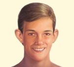 1746556299 oto incision 01 1 1 1 Otoplasty in Miami, FL