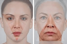 Picture1 Facelift in Miami, FL