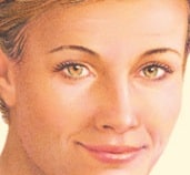 bleph results Cosmetic Eyelid Surgery in Miami, FL